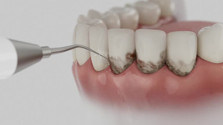 Reliable Tooth Extraction contractor in Putnam County County, GA by Dentist Open Now